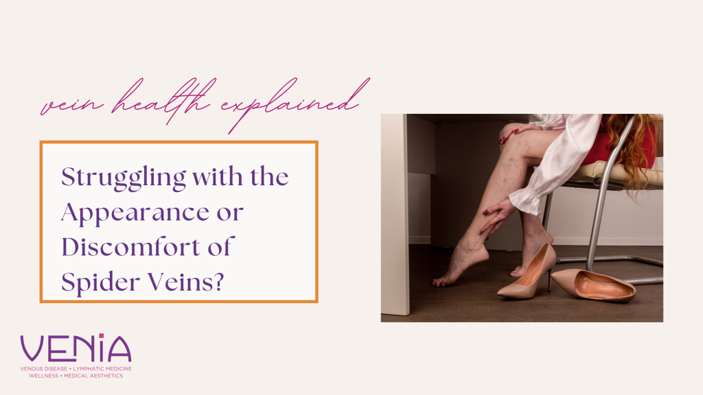 Spider vein treatment Coeur d'Alene