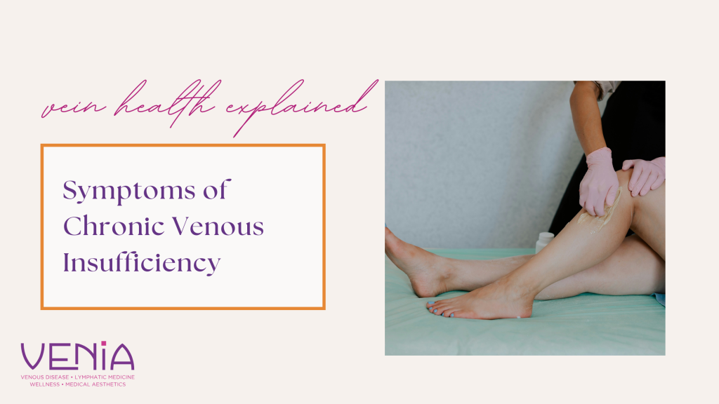 Chronic venous insufficiency Coeur d'Alene