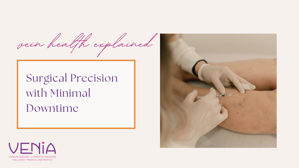 Microphlebectomy for Varicose Veins